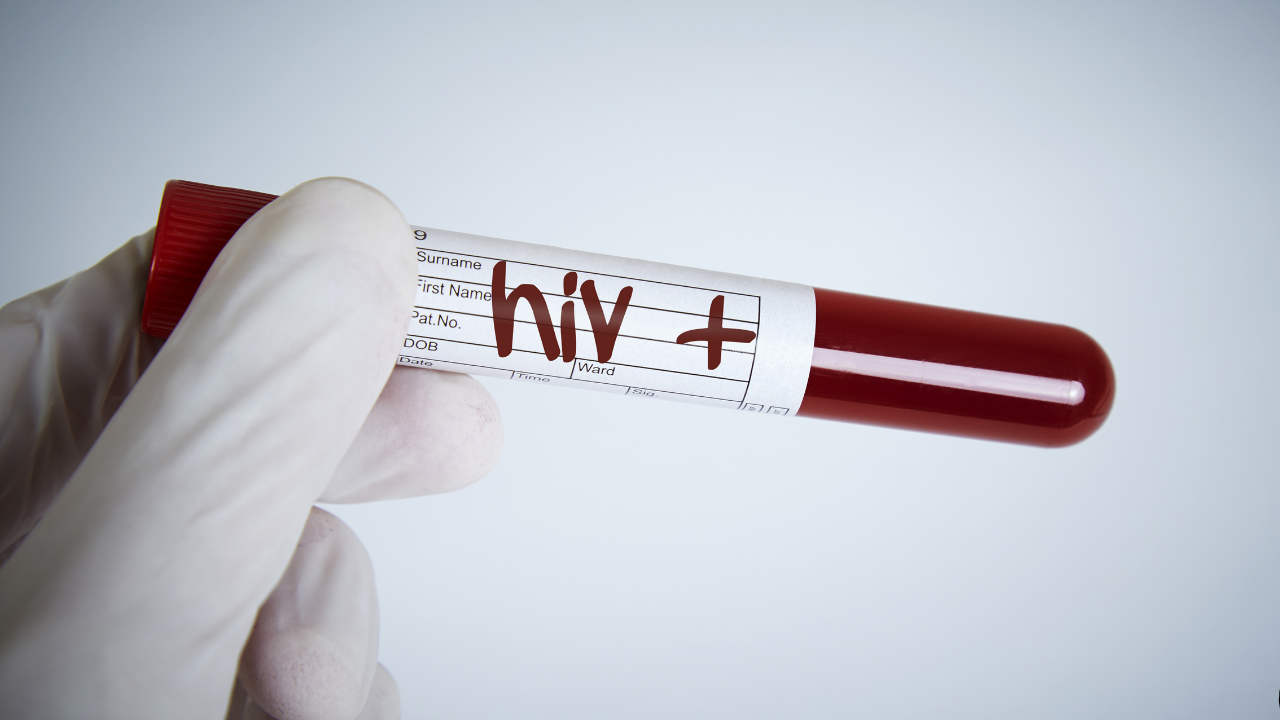 HIV Nedir? HIV Belirtileri, Erken Teşhis ve  Bulaşma Yolları